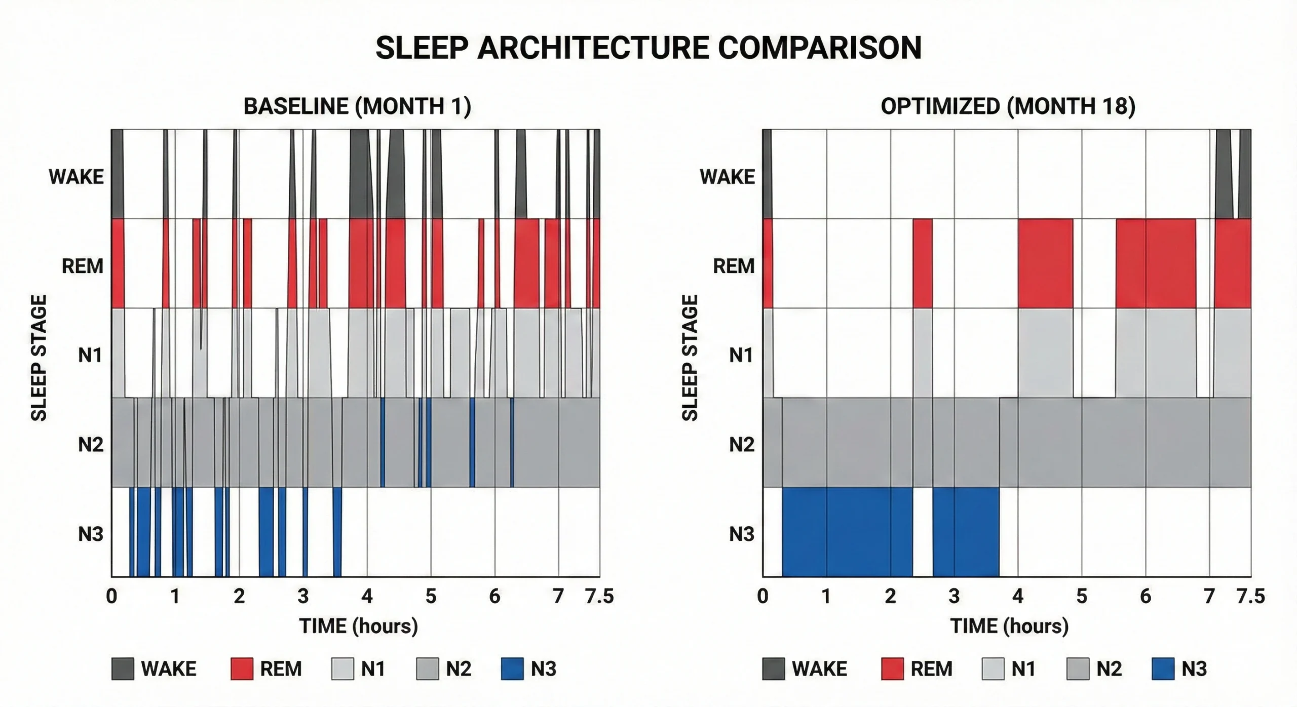 Comparison chart showing characteristics of each sleep stage including brain waves, muscle tone, heart rate, and primary functions for N1, N2, N3 and REM