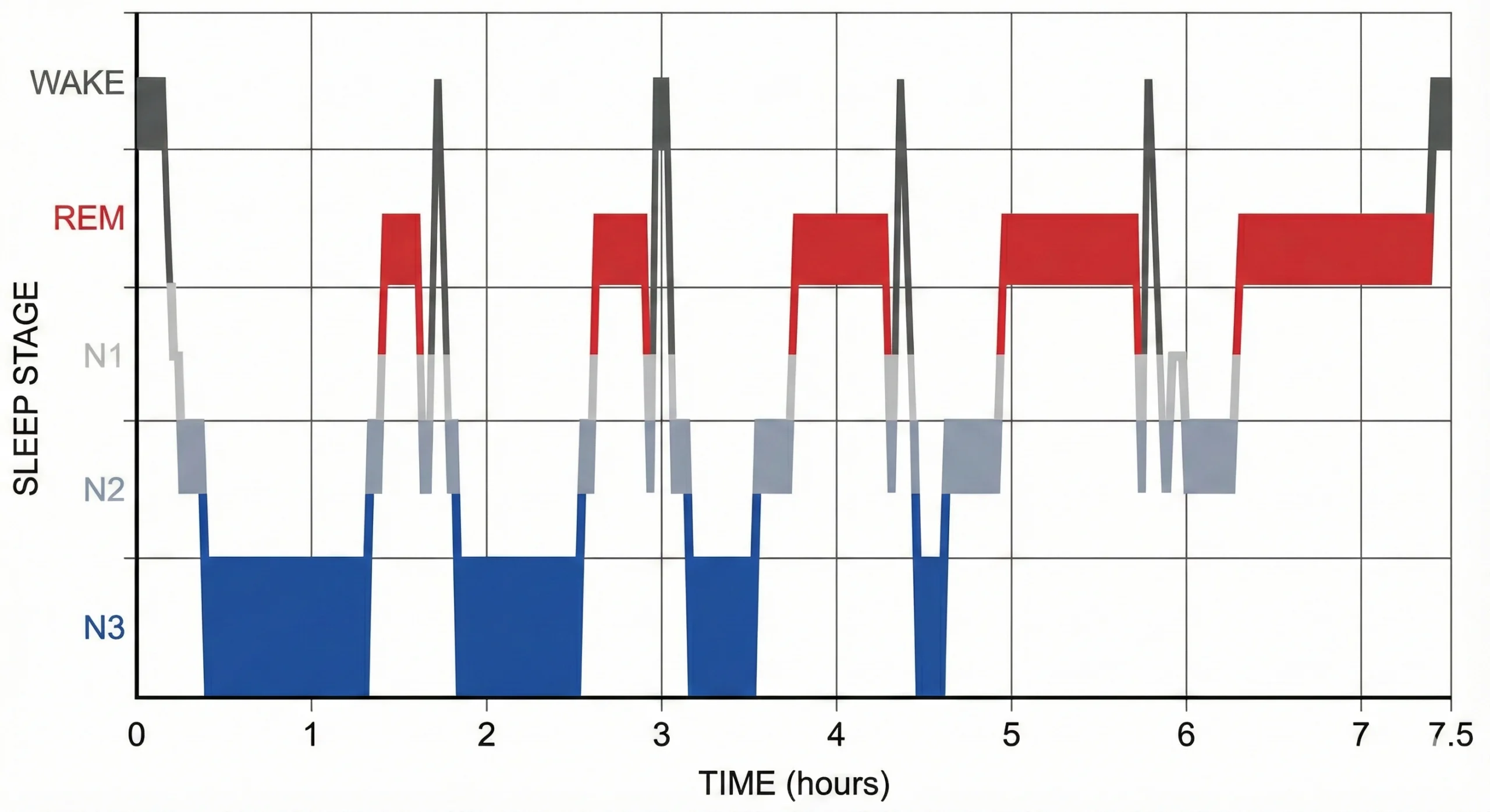 Hypnogram showing complete night of sleep with 5-6 cycles, demonstrating deep sleep dominance in early cycles and REM dominance in later cycles