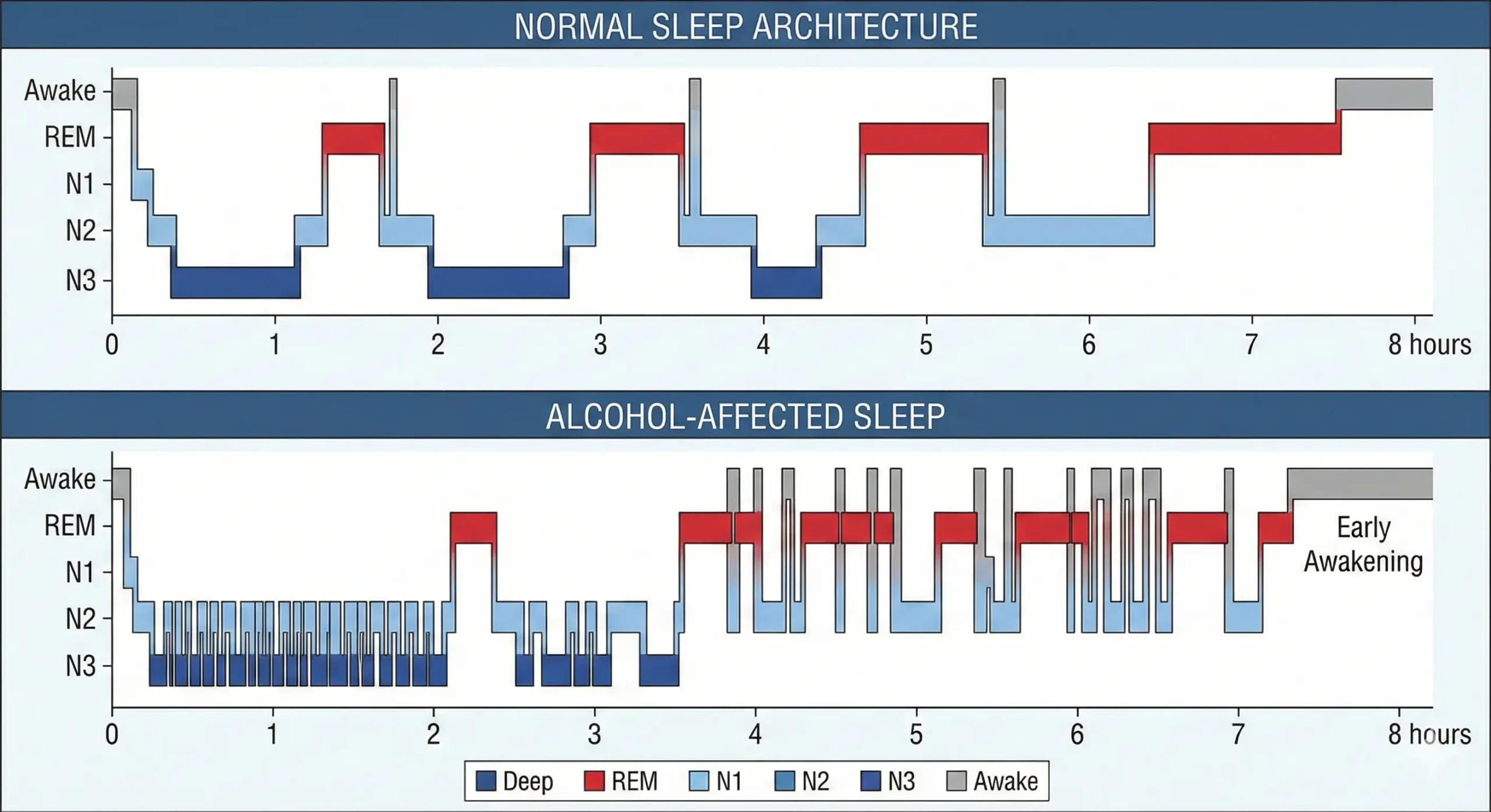 Comparison graph of normal sleep architecture versus alcohol-disrupted sleep showing REM suppression, fragmented sleep cycles, and early morning awakening