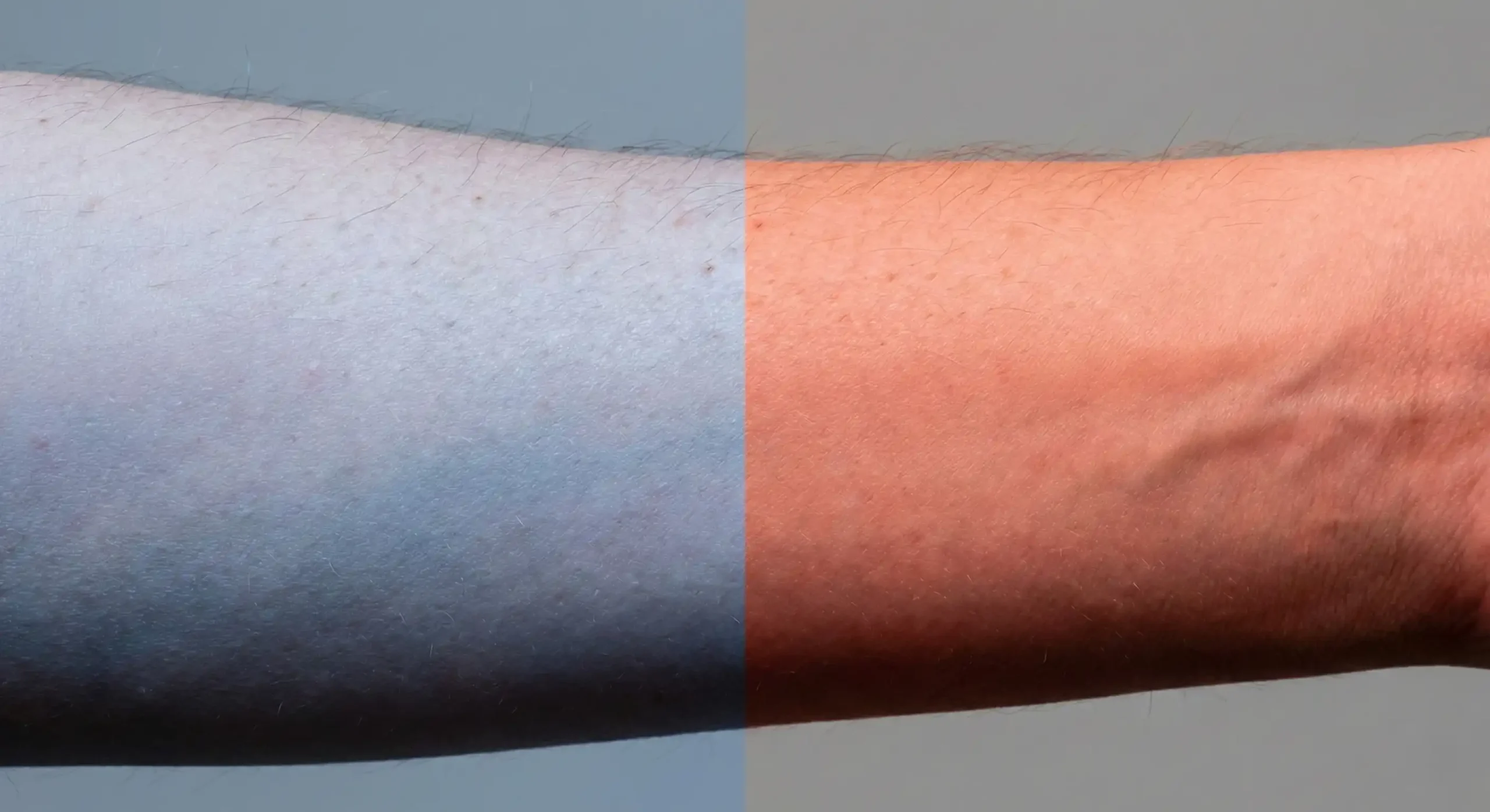 Blue light versus red light exposure on human skin and circadian rhythm