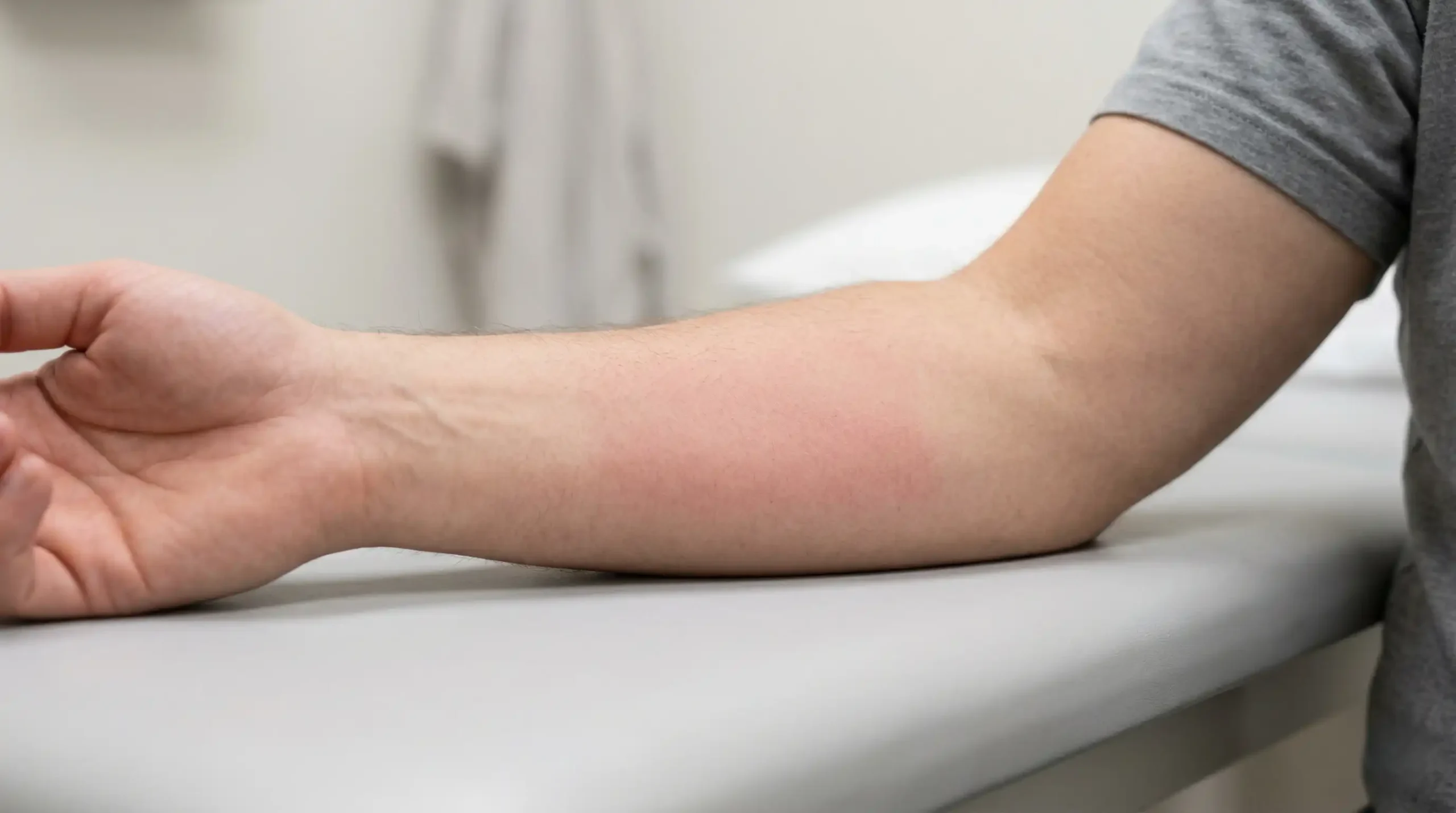 Close-up of skin showing mild temporary redness after red light therapy session demonstrating normal photobiomodulation skin response